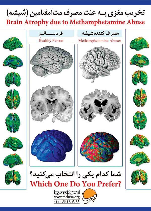 پوستر مصرف شیشه (مت‌آمفتامین) با ما چه می‌کند؟